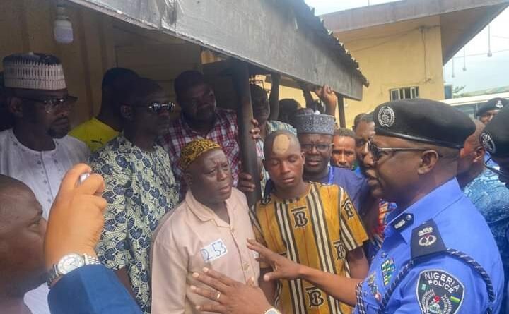 Lagos CP Visits Okada Man Brutalised By Police, Assures Of Disciplinary Measures Against Erring Officers